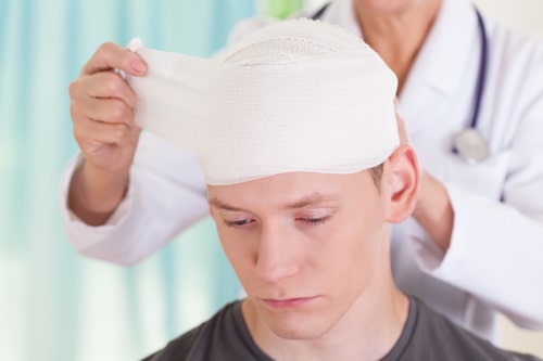 Long Term Effects of Traumatic Brain Injury